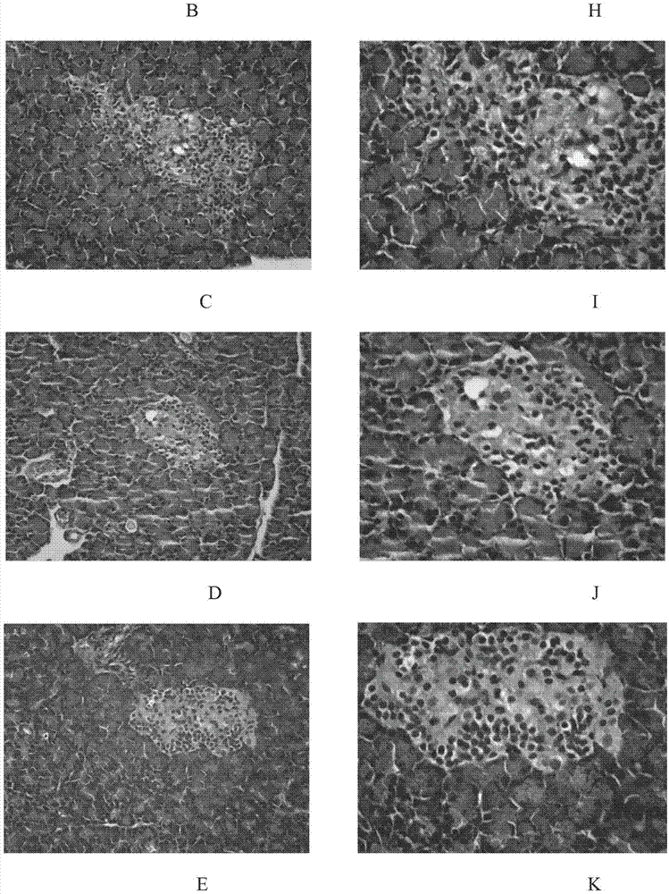 Applications of Tianshen capsules in preparation of drug used for treating type 2 diabetes lipid metabolic disorders and atherosclerosis