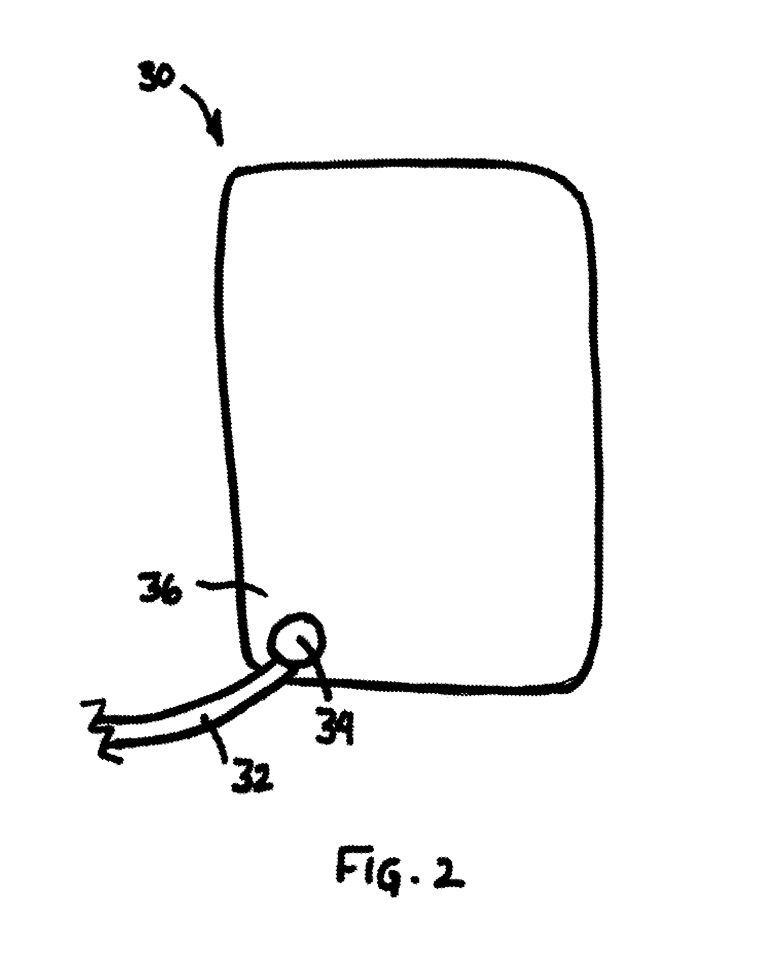 Automatic external defibrillator for implatable cardiac defibrillator patients undergoing procedures involving electromagnetic interference