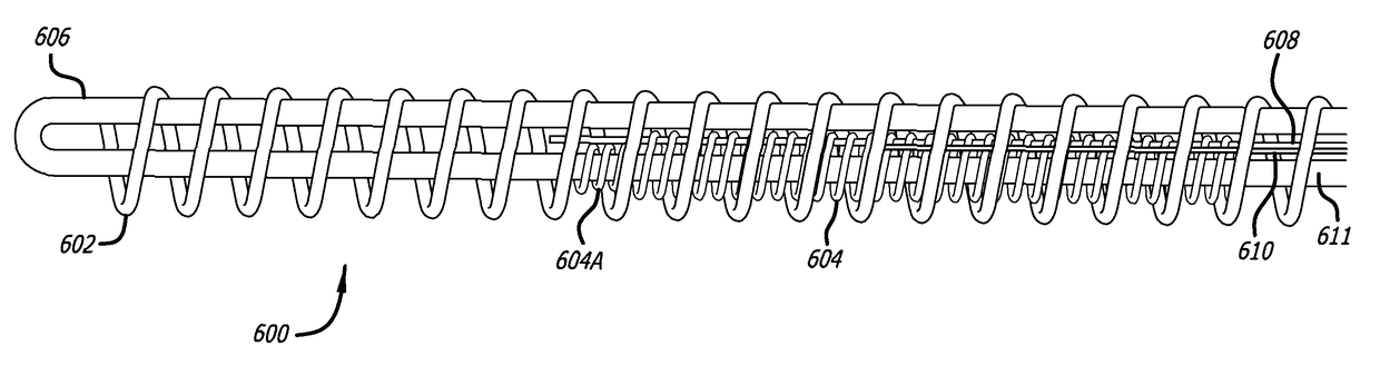 Implant delivery system