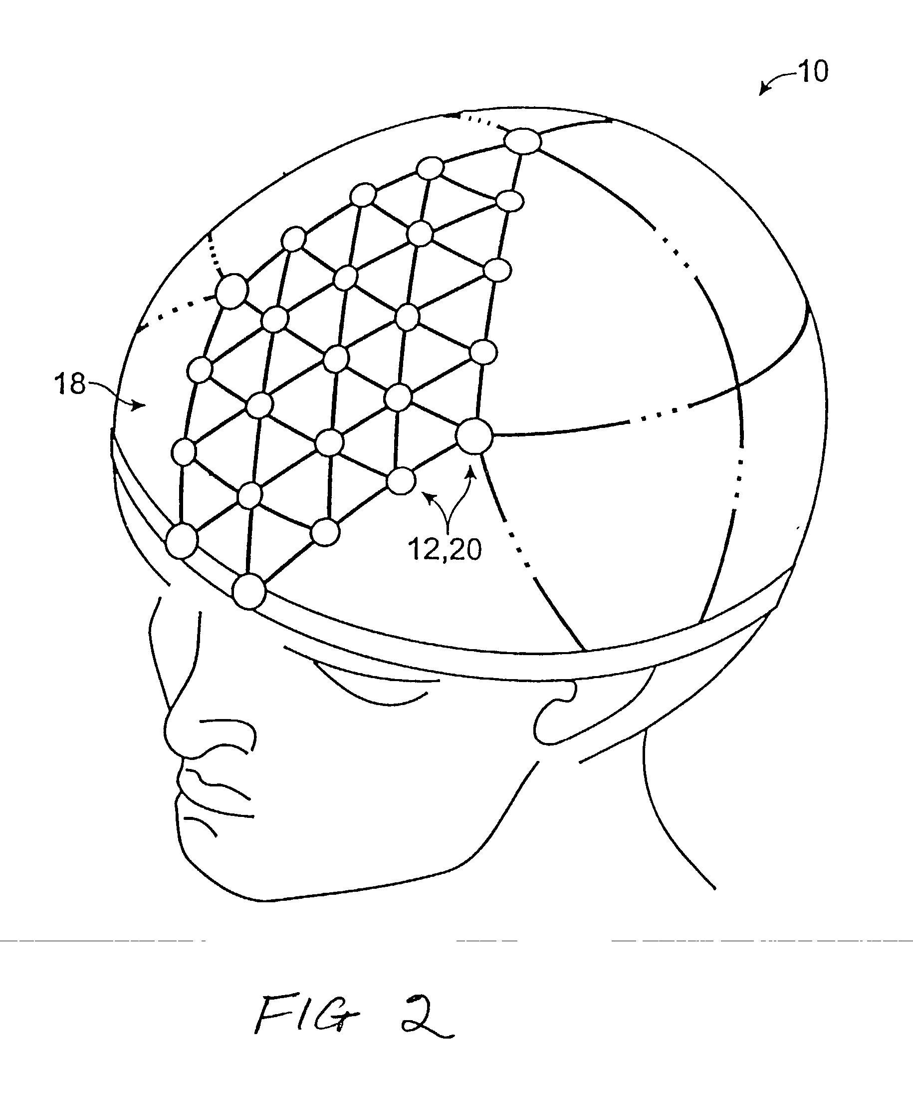 Method for neural current imaging