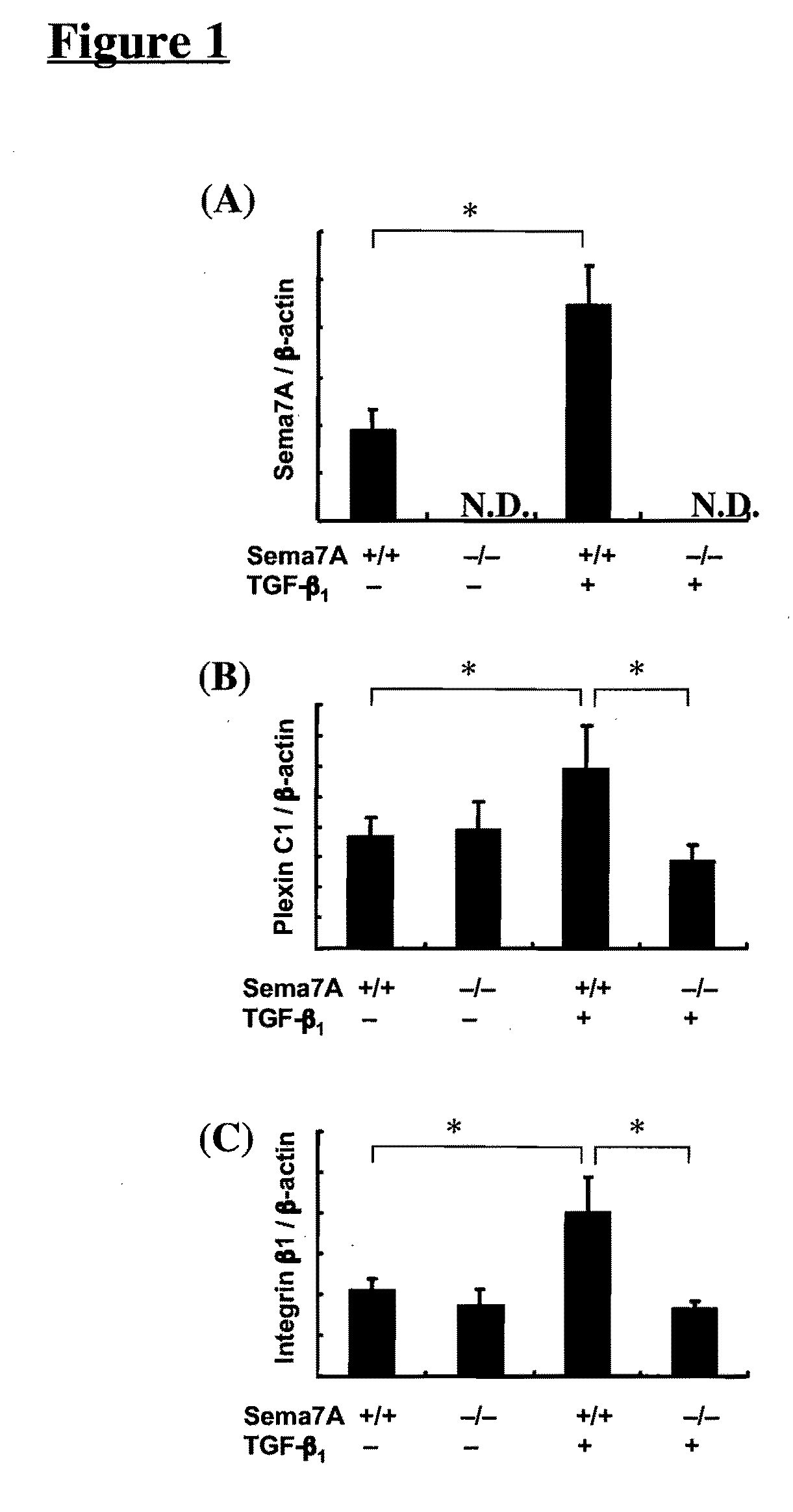 Semaphorin 7A Plays a Critical Role in TGF-Beta1-Induced Pulmonary Fibrosis and Alveolar Destruction