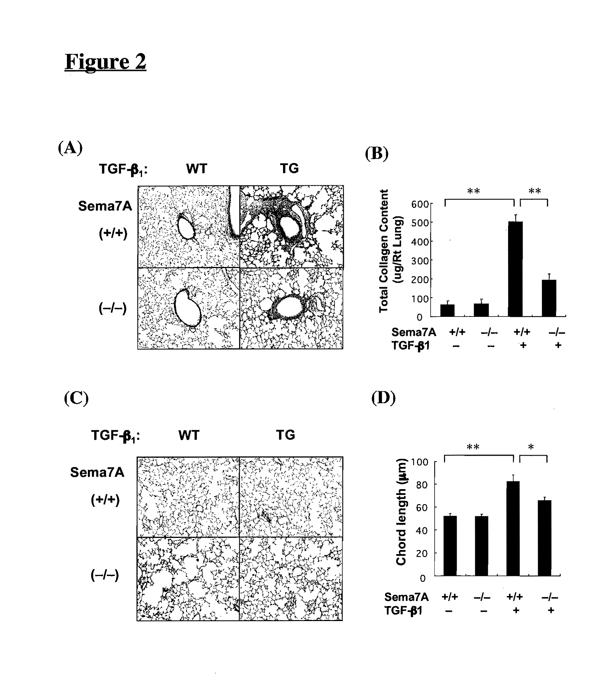 Semaphorin 7A Plays a Critical Role in TGF-Beta1-Induced Pulmonary Fibrosis and Alveolar Destruction