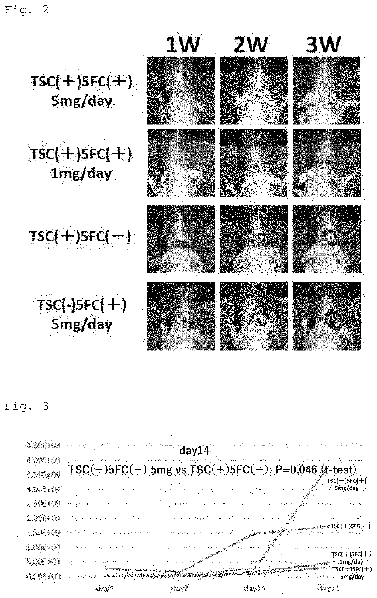 Suicide gene therapeutic agent for brain tumors using pluripotent stem cell