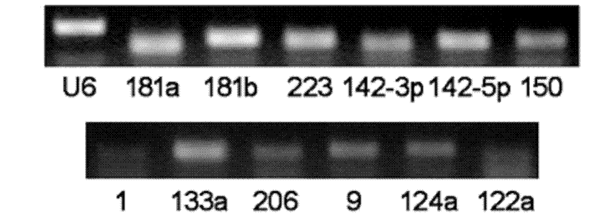 Gastric cancer detection marker and detecting method thereof, kit and biochip