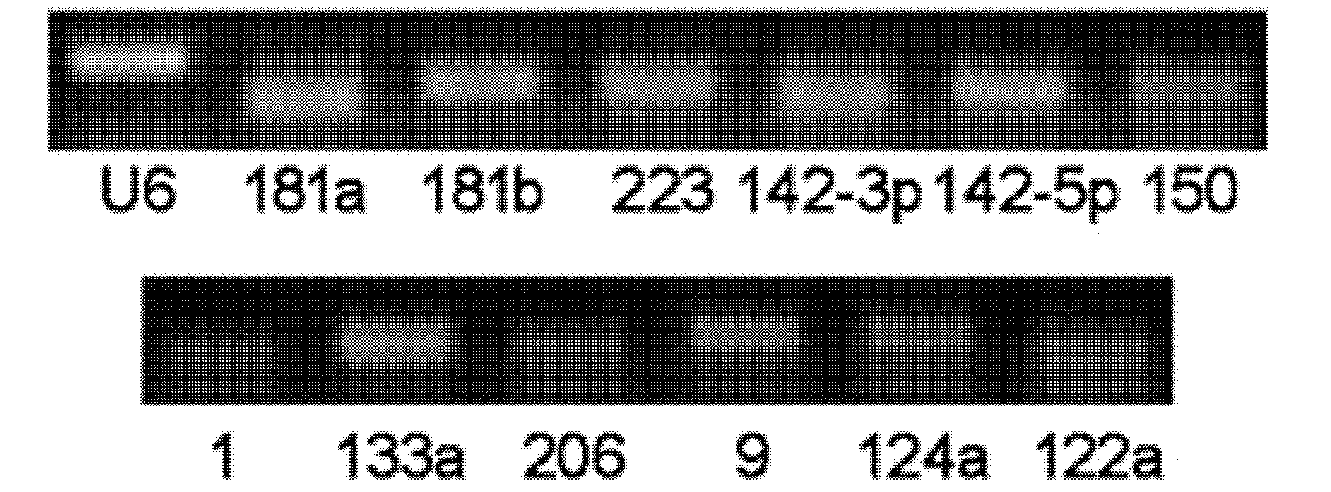 Gastric cancer detection marker and detecting method thereof, kit and biochip