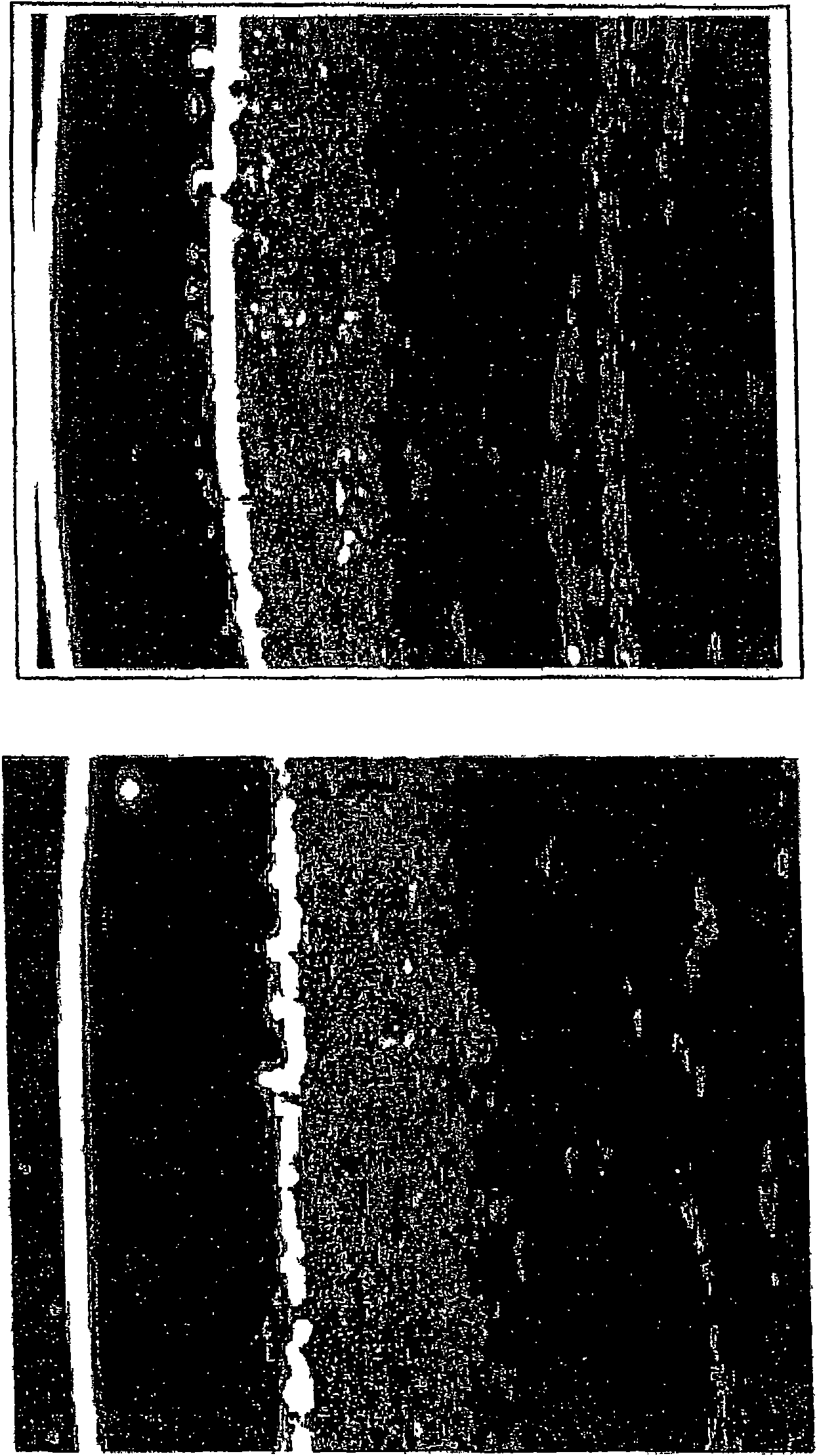 Combination of a glucocorticoid and a ss-cyclodextrin conjugated vitamin a derivate complex