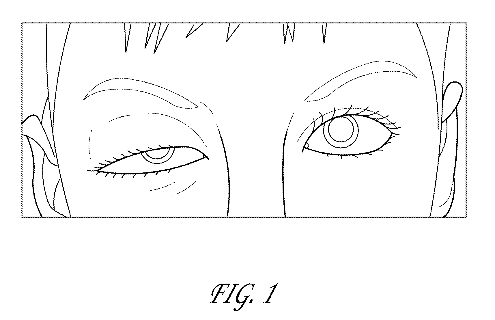 Surgical correction of ptosis by polymeric artificial muscles