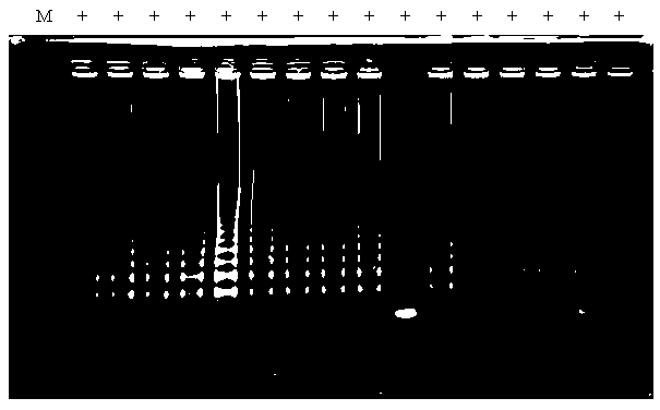 Method and kit for detecting tubercle bacillus