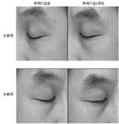 Hibiseu manihot Lanti-aging composition, preparation method and application thereof