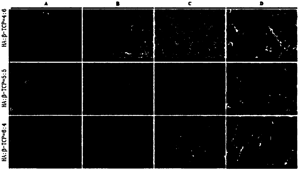 Dental bone graft materials of biphasic calcium phosphate type composed of hydroxyapatite and beta-tricalcium phosphate synthesized from the shell of abalone and preparation method thereof