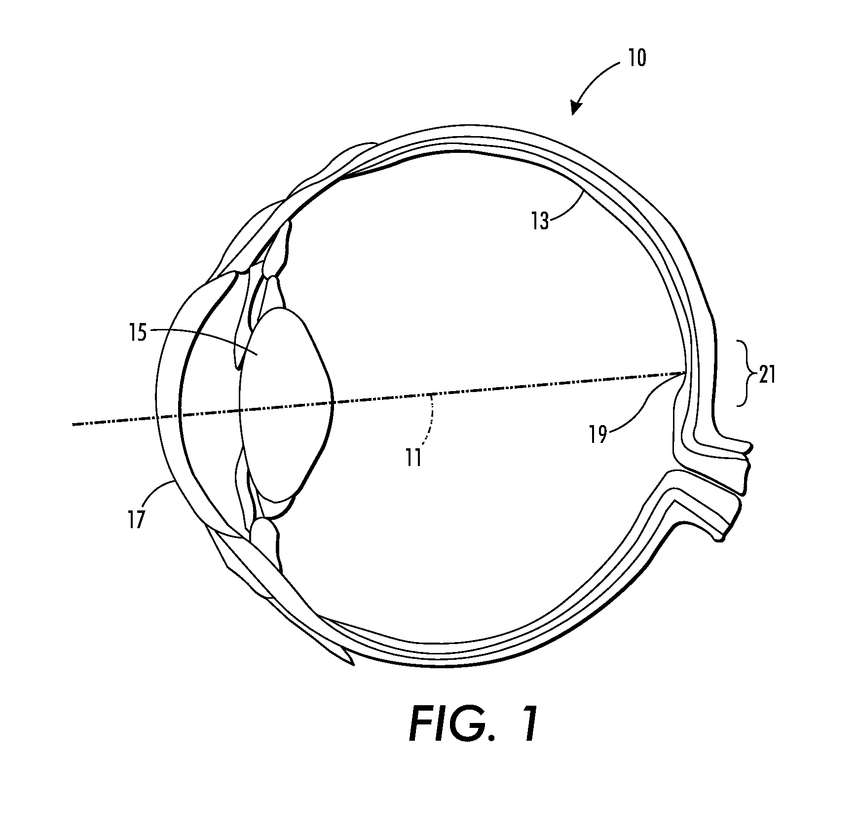 Central vision impairment compensation