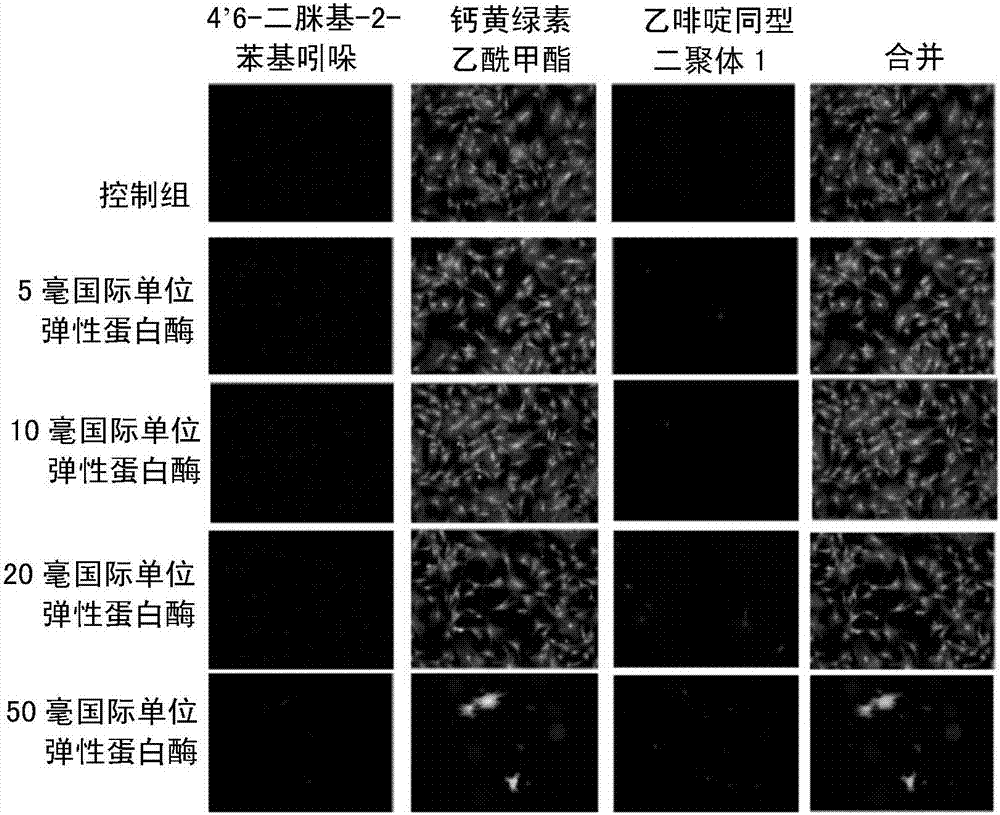 Application of burdock extract in preparing medicine for protecting elastic fibers and collagen