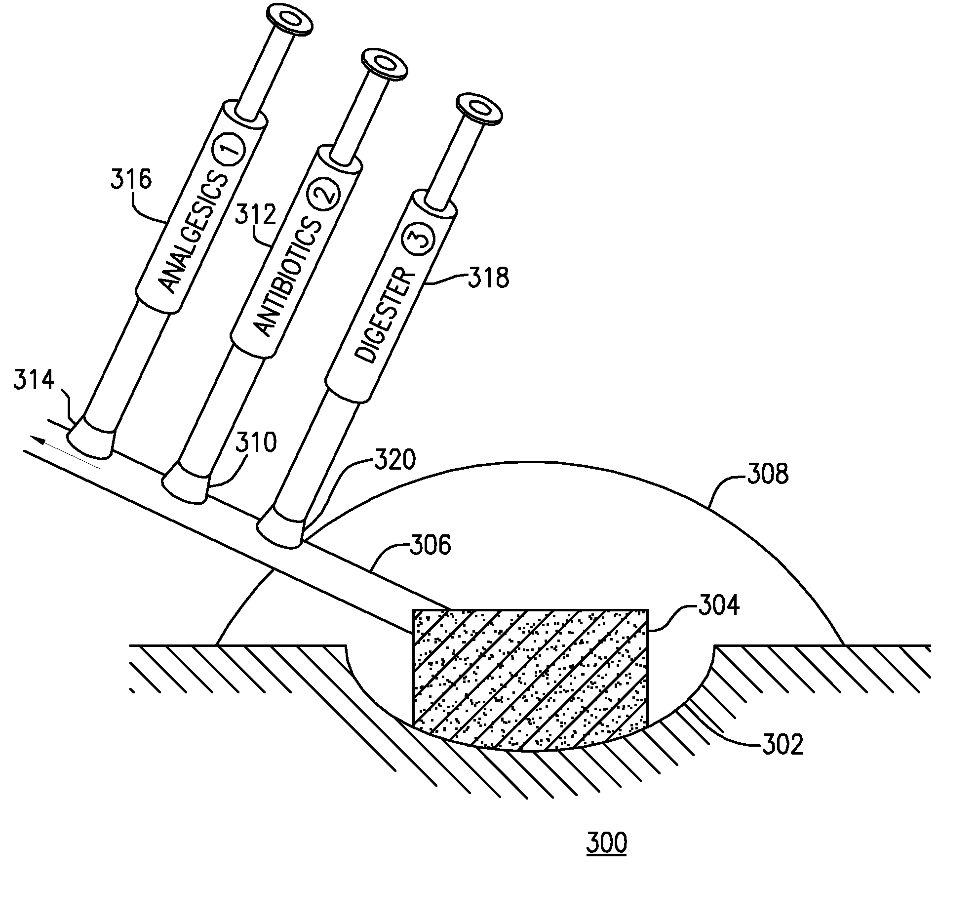 Systems and methods for providing a debriding wound vacuum