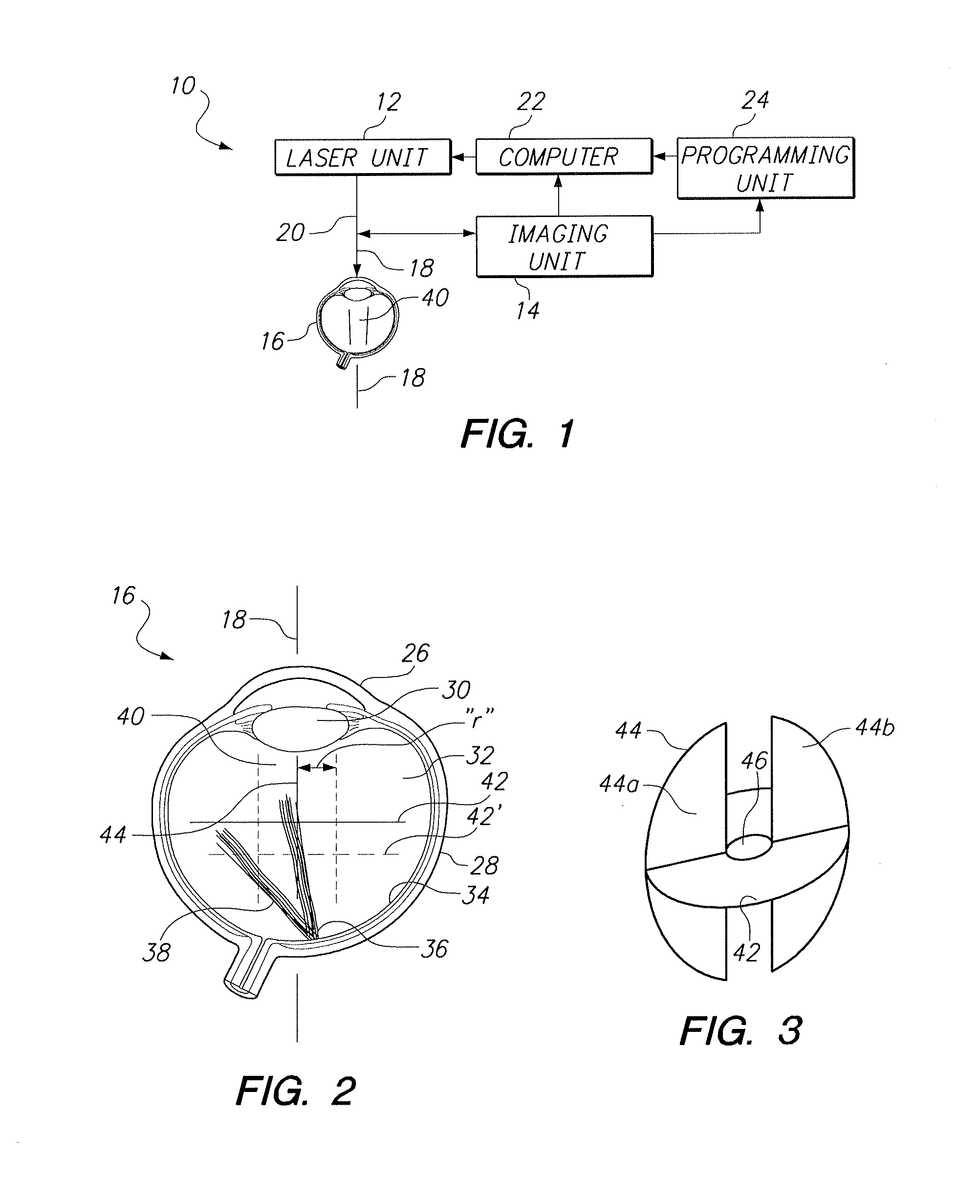 Interventional Treatments for VitreoRetinal-Interface Syndromes