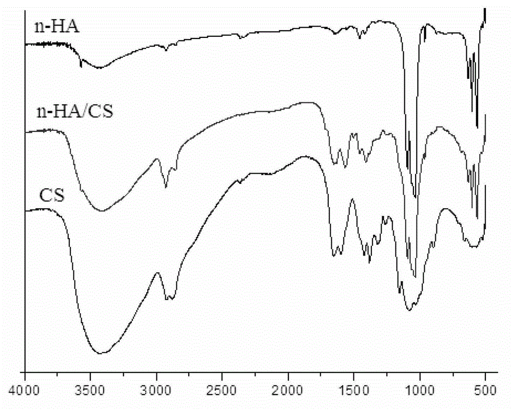 Preparation method of nano-hydroxyapatite/chitosan