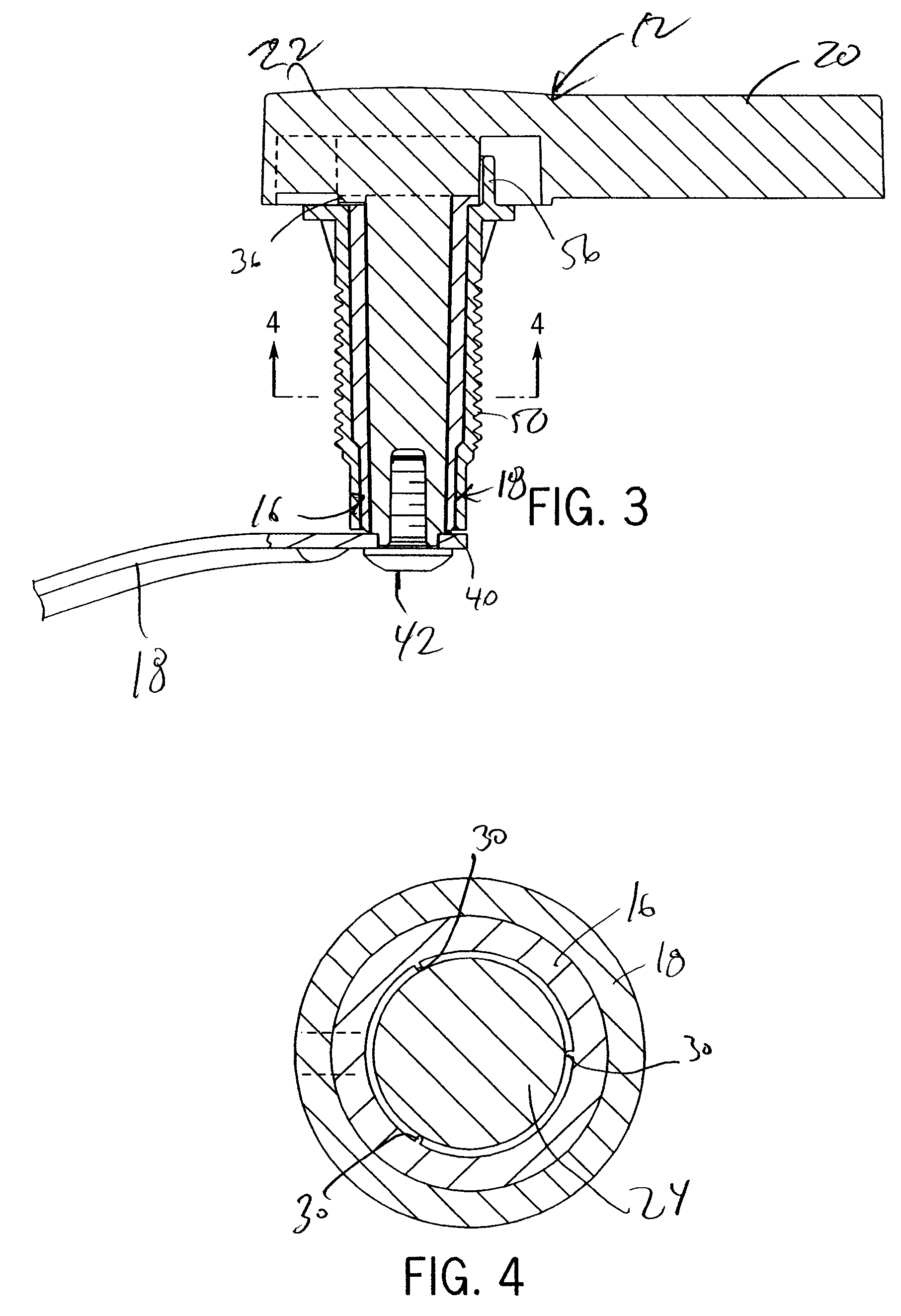 Trip lever assembly