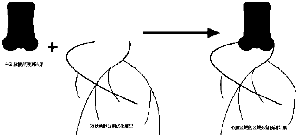 Method and device for segmenting coronary arteries