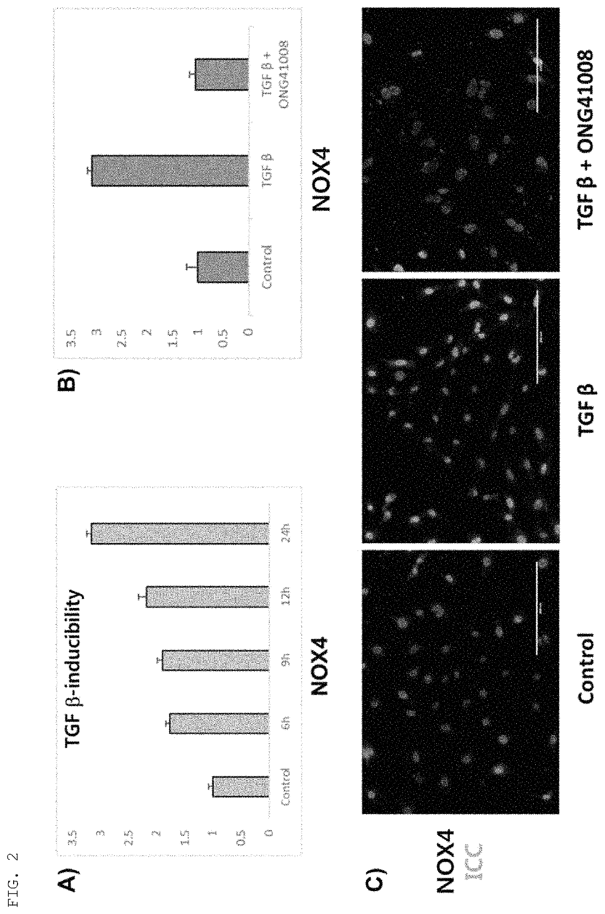 Anti-inflammatory composition