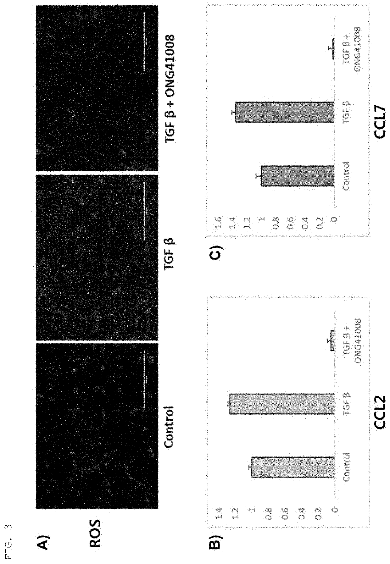 Anti-inflammatory composition