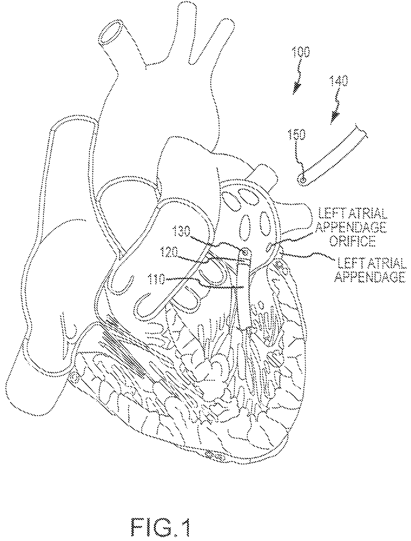 Magnetic navigation systems and methods