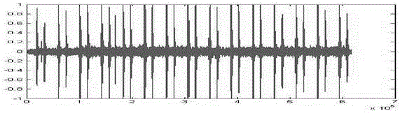 Heart-sound enhancement method based on improved spectral subtraction