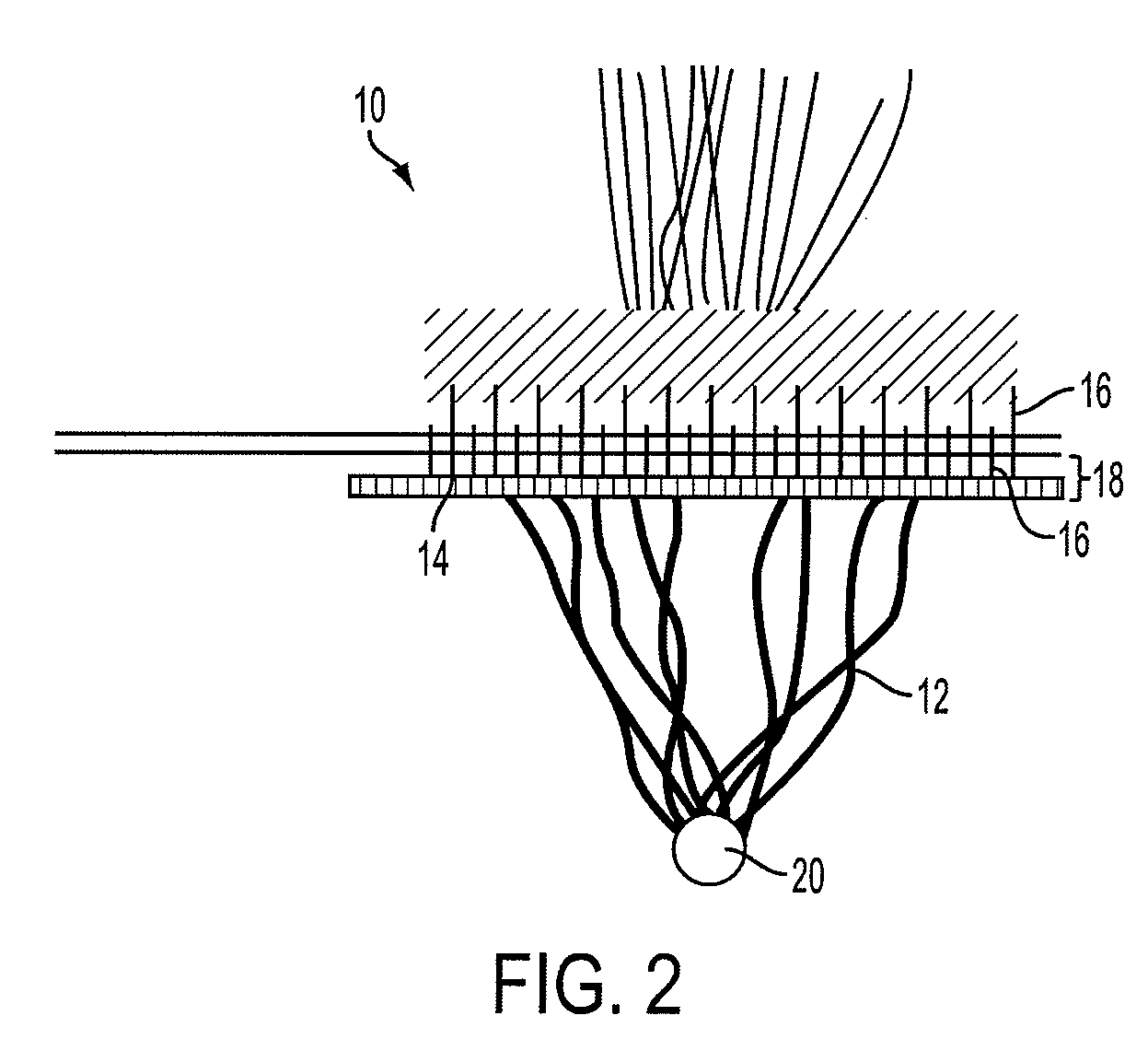 Methods and Compositions for Optimizing the Outcomes of Refractive Laser Surgery of the Cornea