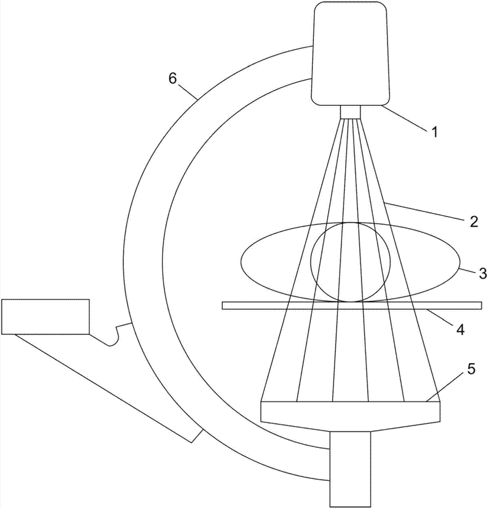 Method for acquisition of subtraction angiograms