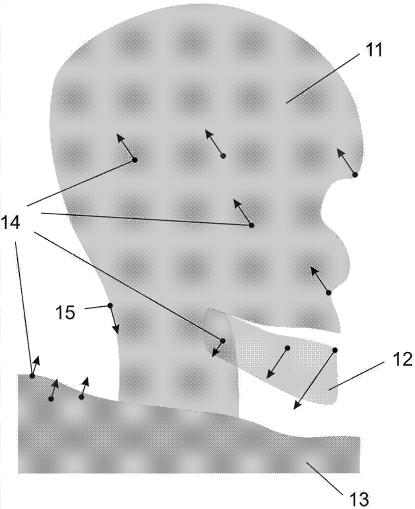 Method for acquisition of subtraction angiograms