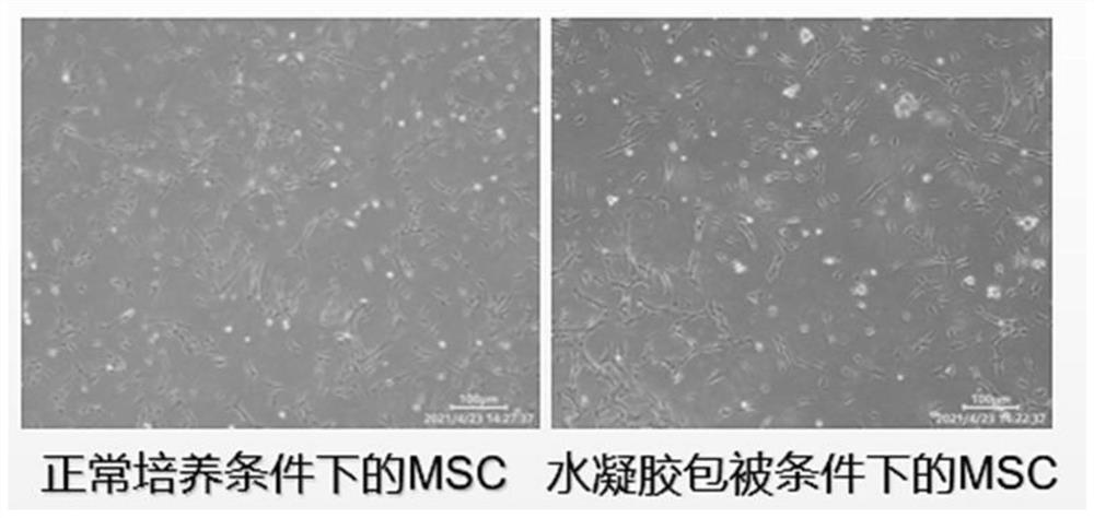 Temperature-sensitive hydrogel loaded with umbilical cord mesenchymal stem cells and preparation method of temperature-sensitive hydrogel