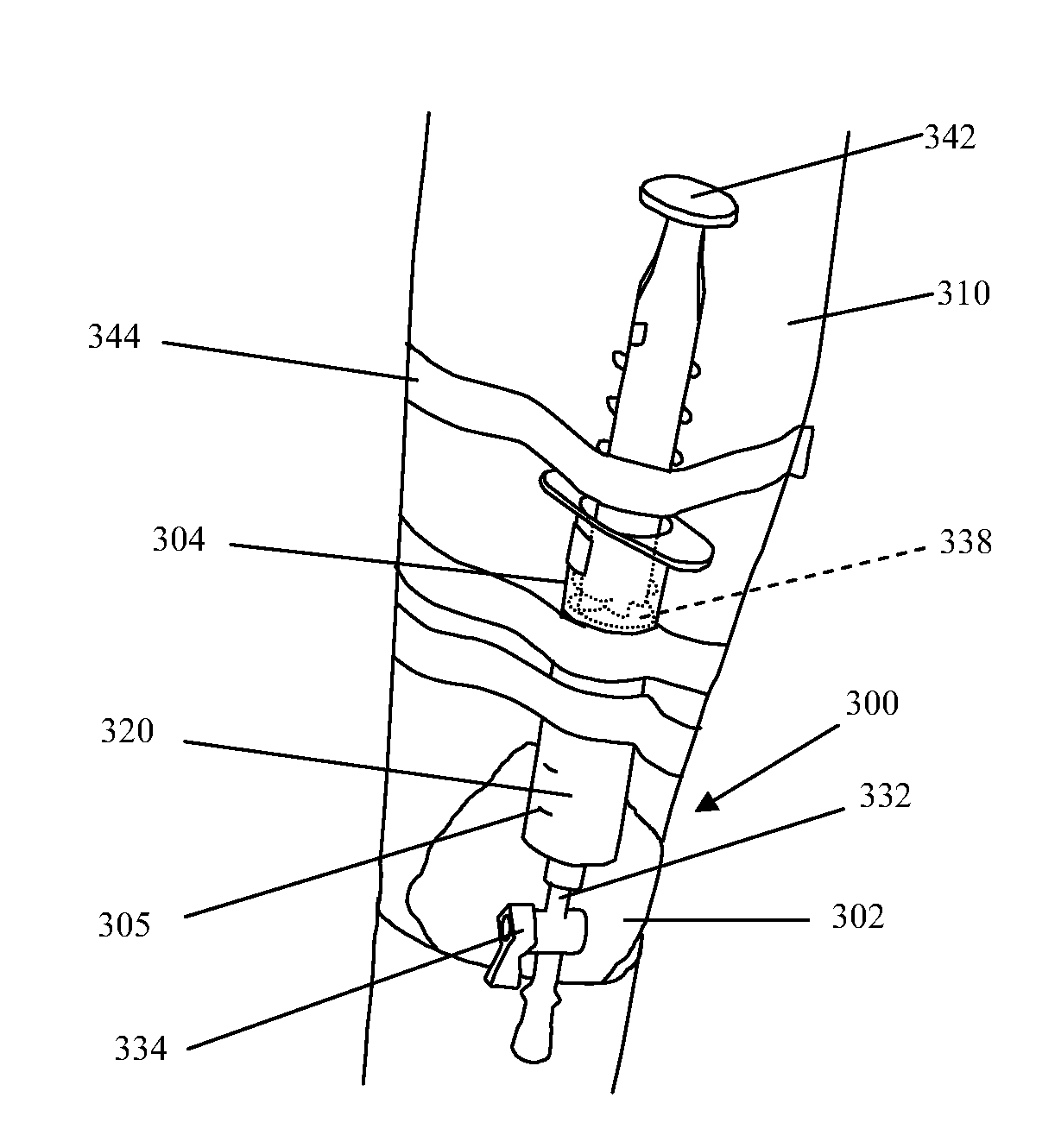 Reduced pressure therapy devices