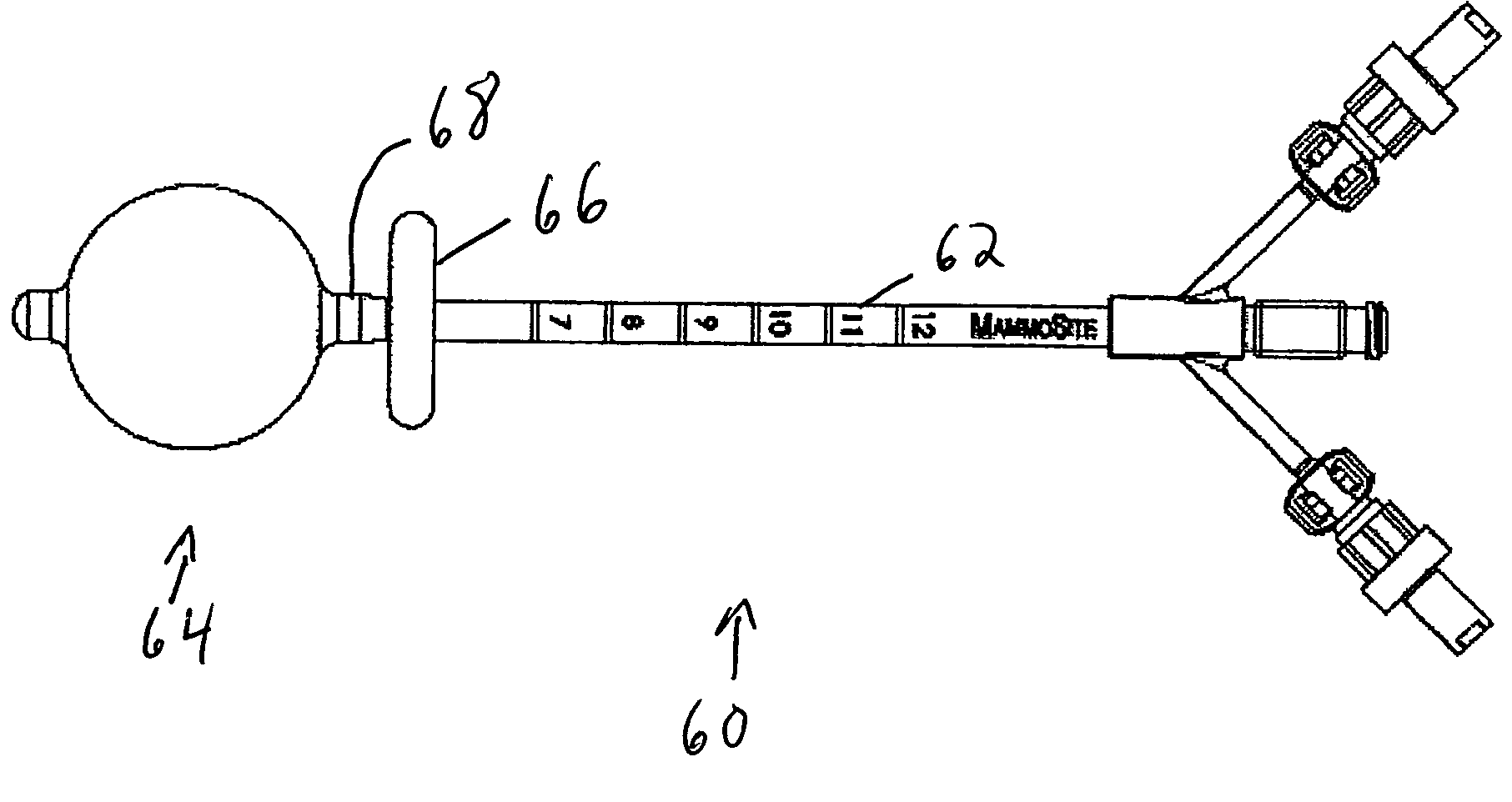 Tissue positioning systems and methods for use with radiation therapy