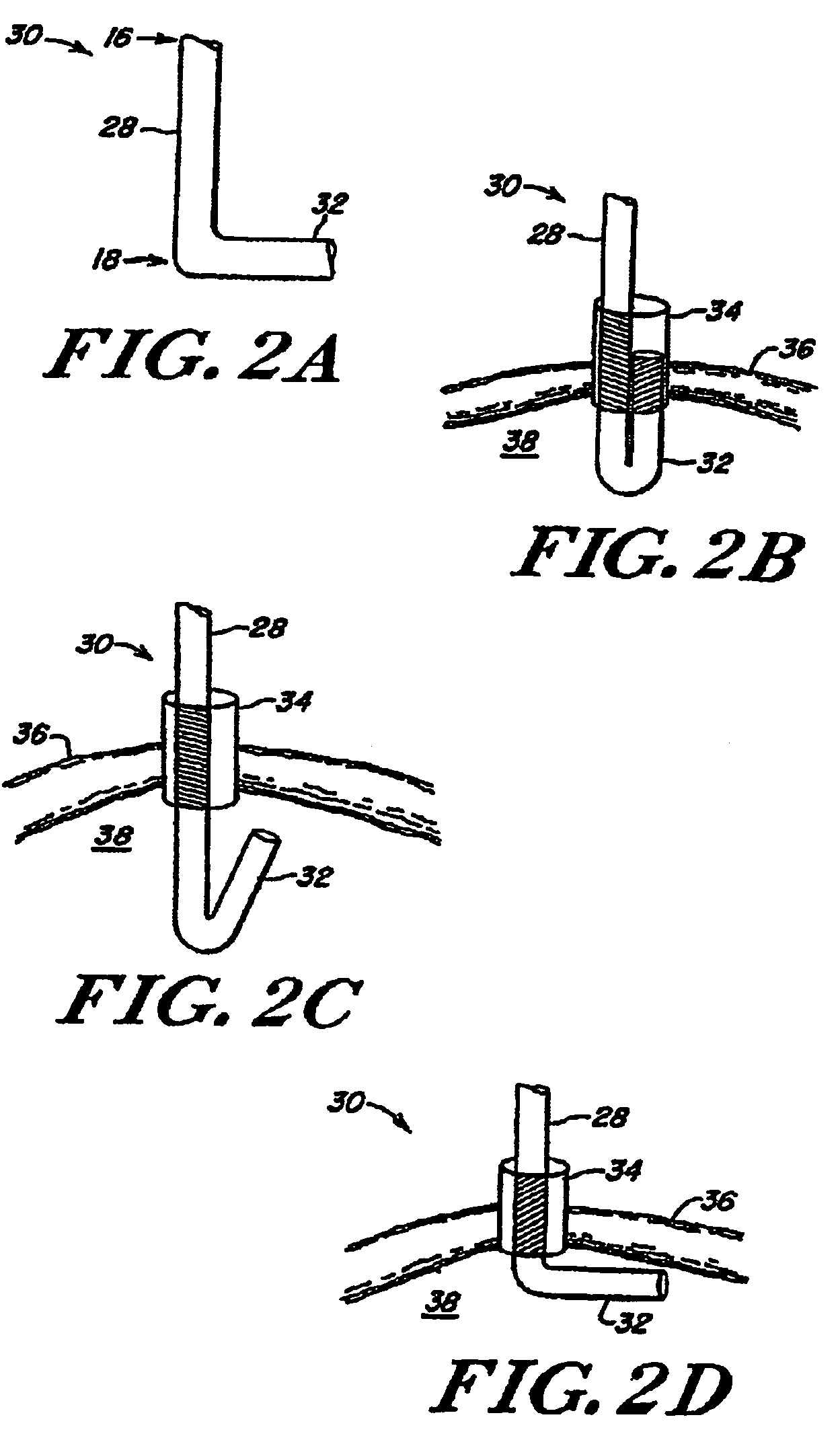 Tissue positioning systems and methods for use with radiation therapy