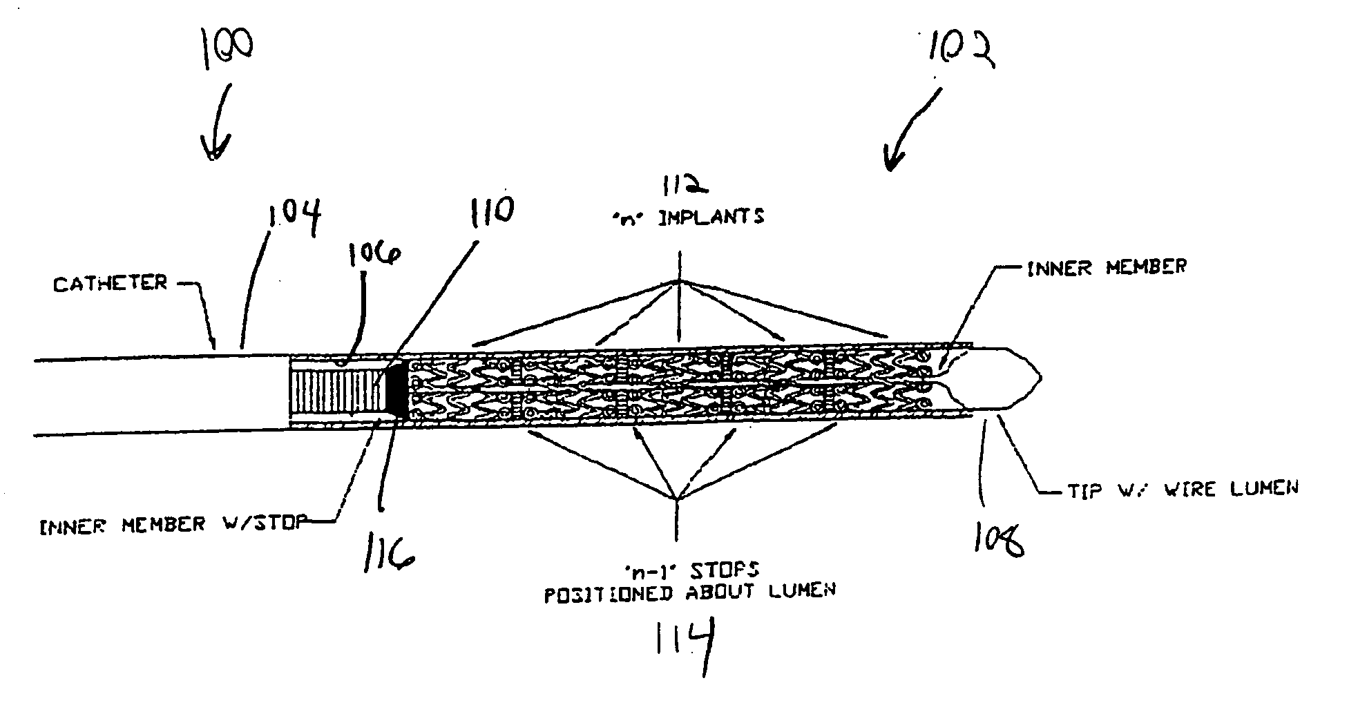 Multiple in vivo implant delivery device