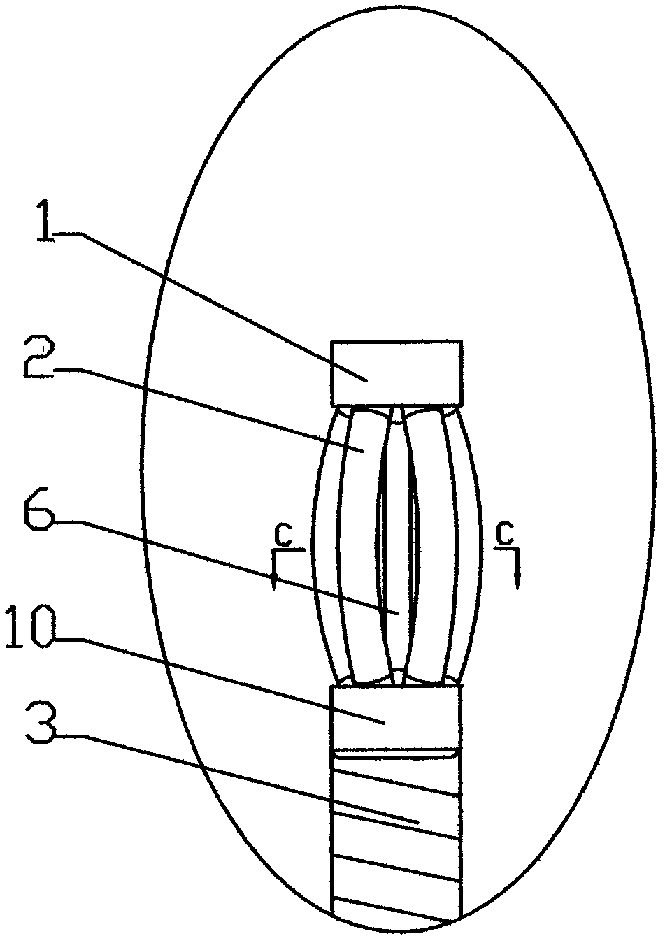 Gallbladder and bile duct calculus remover