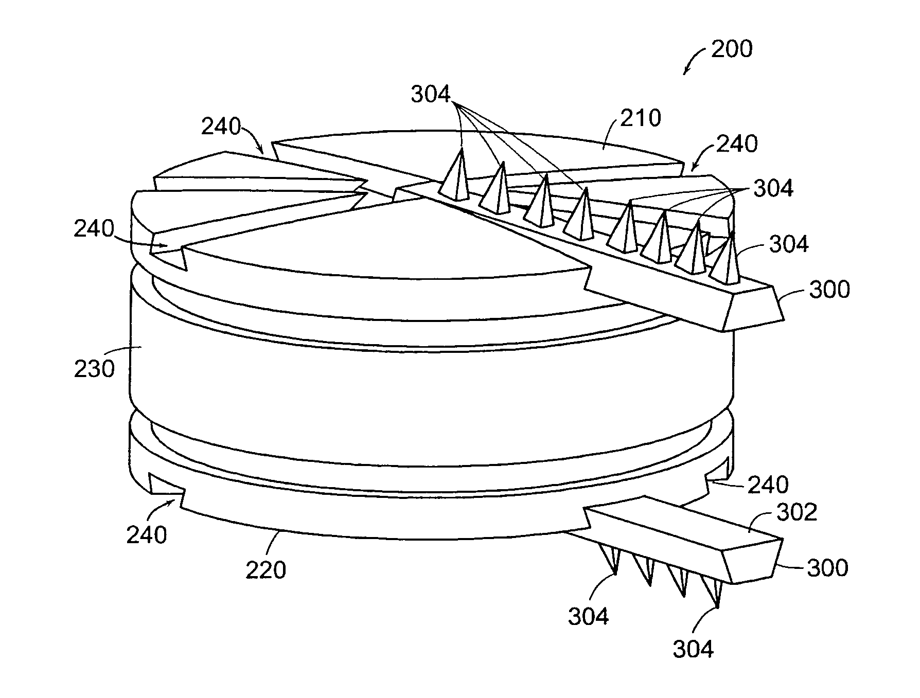Method and apparatus for implant stability