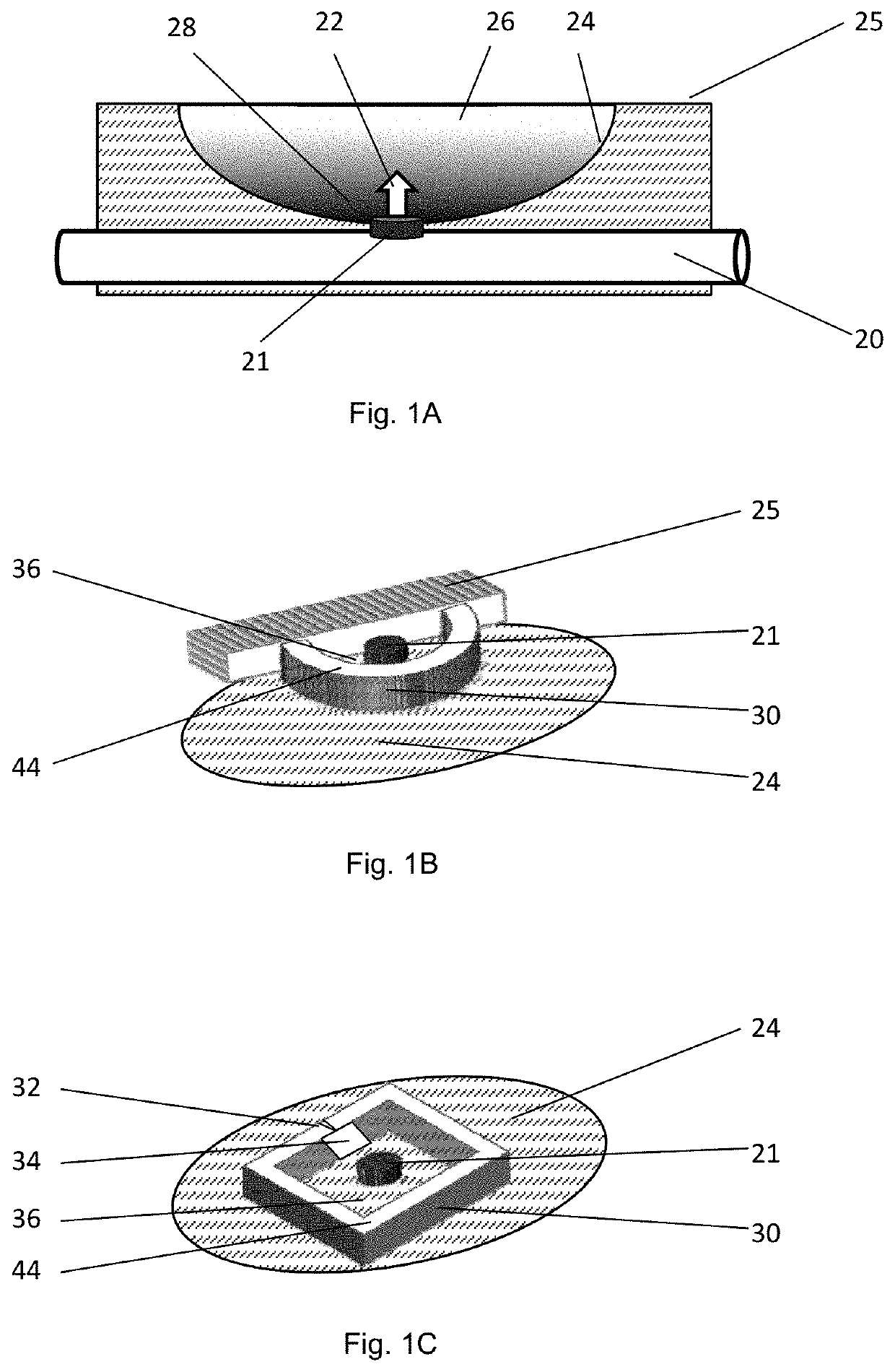 Containment devices for treatment of intestinal fistulas and complex wounds