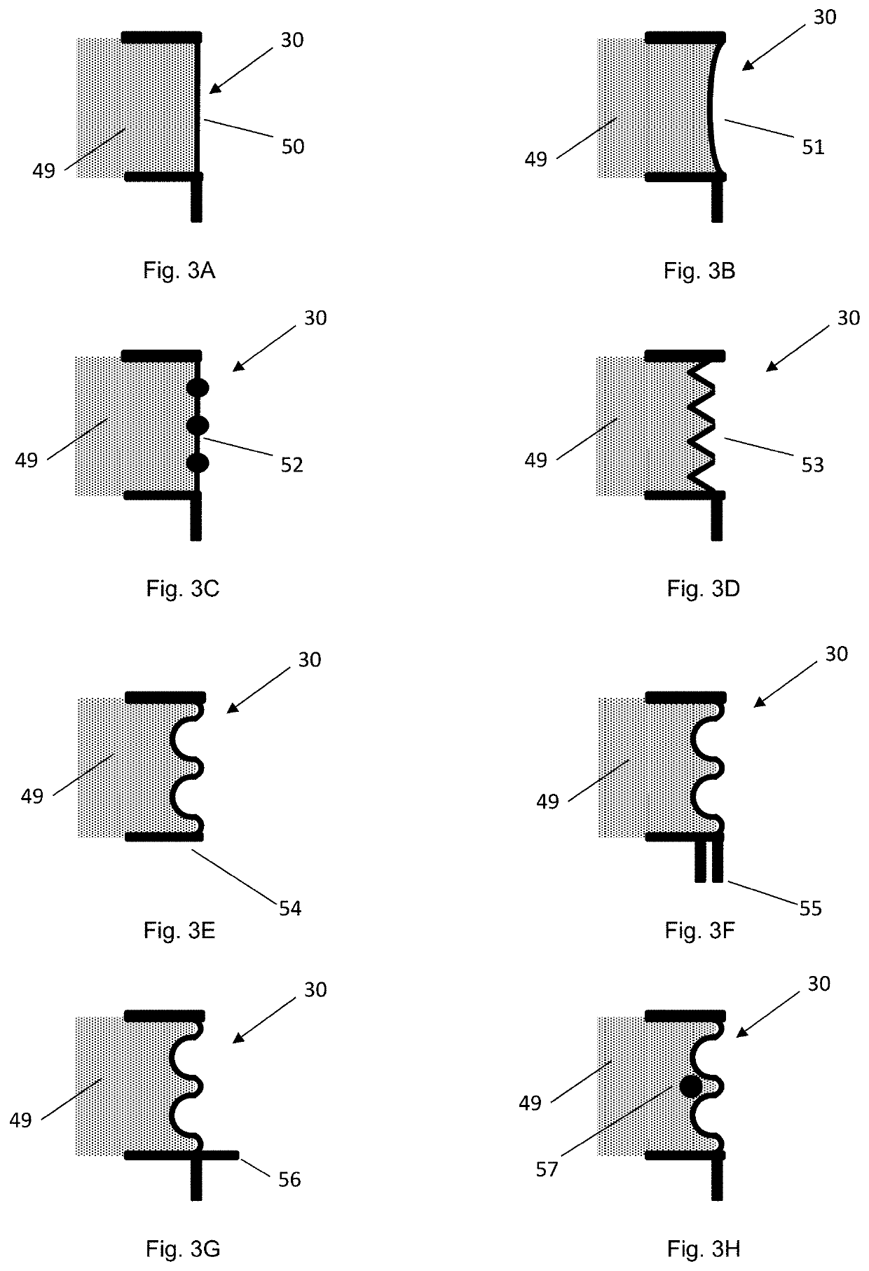 Containment devices for treatment of intestinal fistulas and complex wounds