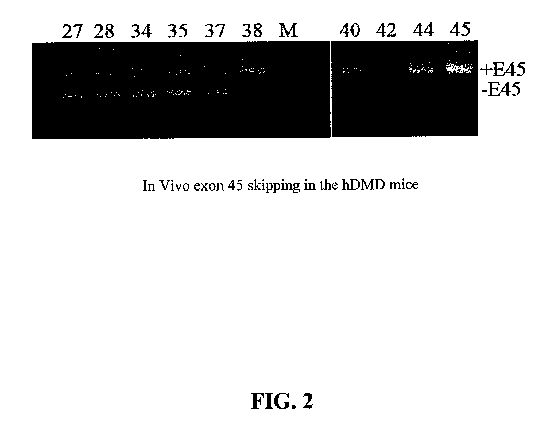 Antisense oligonucleotides