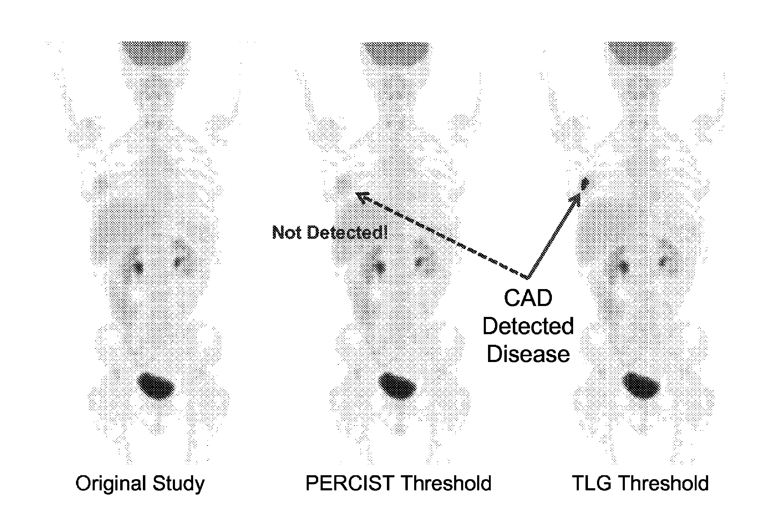 Computer-aided detection (CAD) system for personalized disease detection, assessment, and tracking, in medical imaging based on user selectable criteria