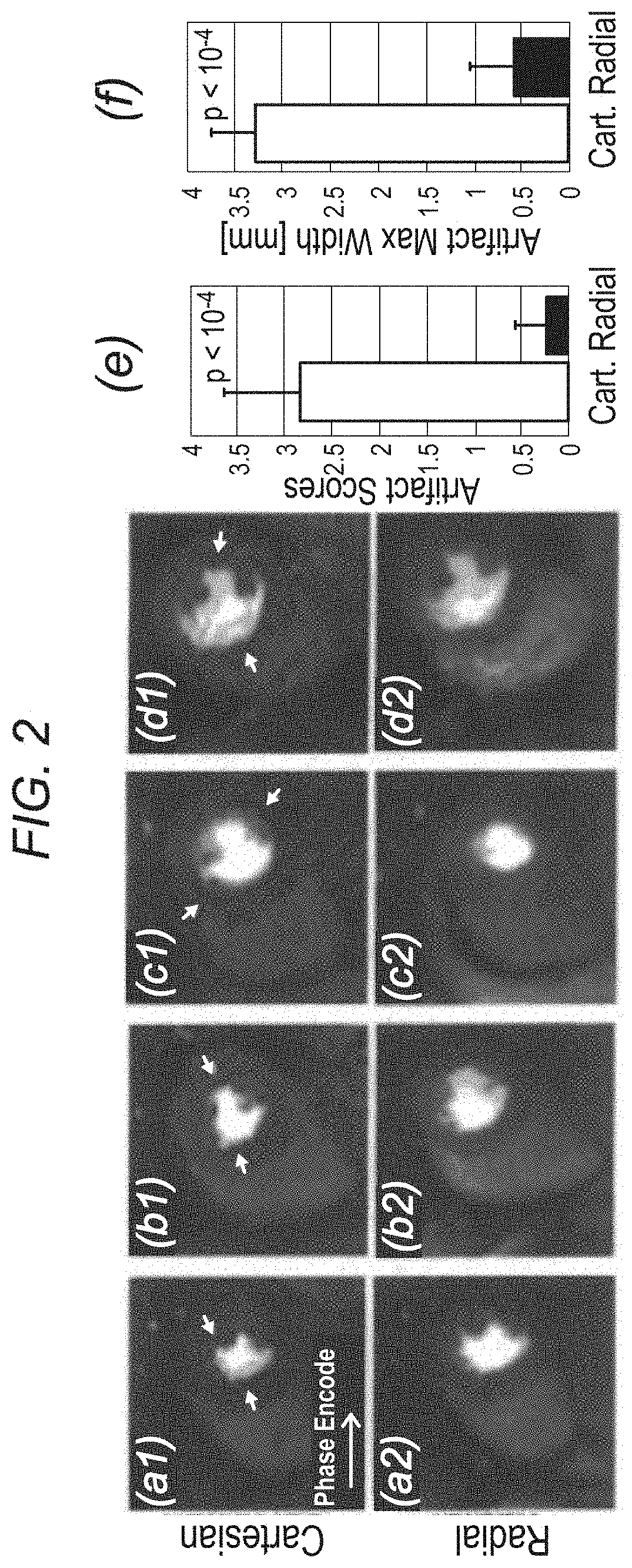 Systems and methods for myocardial perfusion MRI without the need for ECG gating and additional systems and methods for improved cardiac imaging