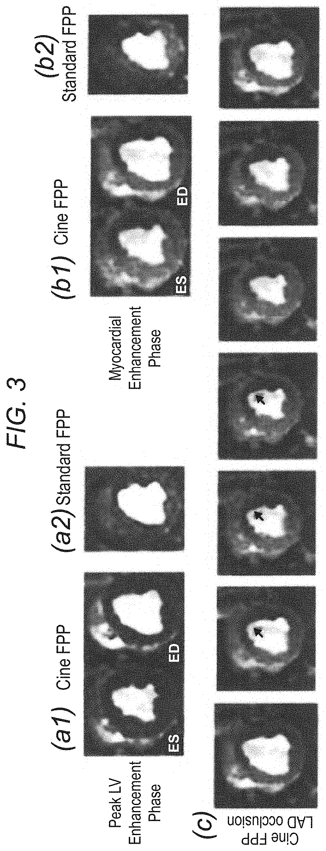 Systems and methods for myocardial perfusion MRI without the need for ECG gating and additional systems and methods for improved cardiac imaging