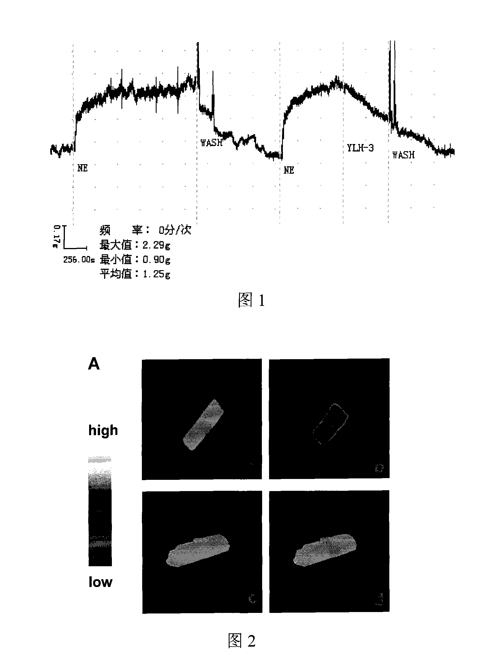 Application of sterides in preparing medicament for treating cardiovascular and cerebrovascular diseases