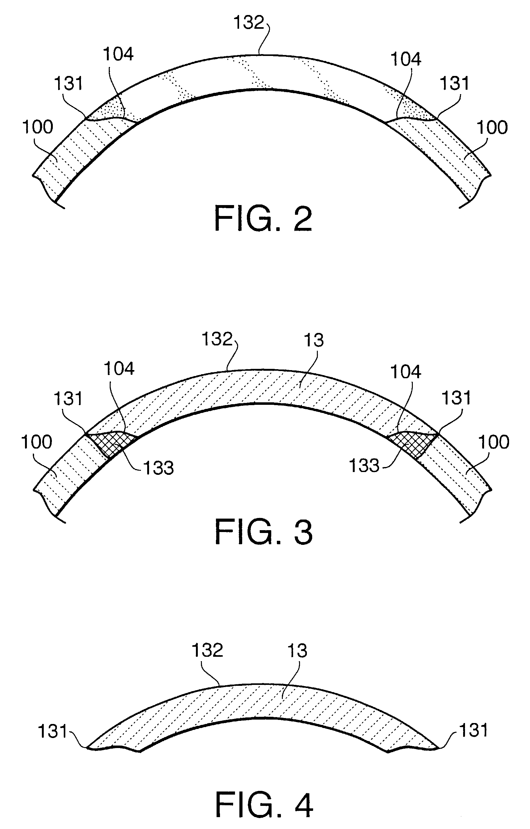 Implant forming method