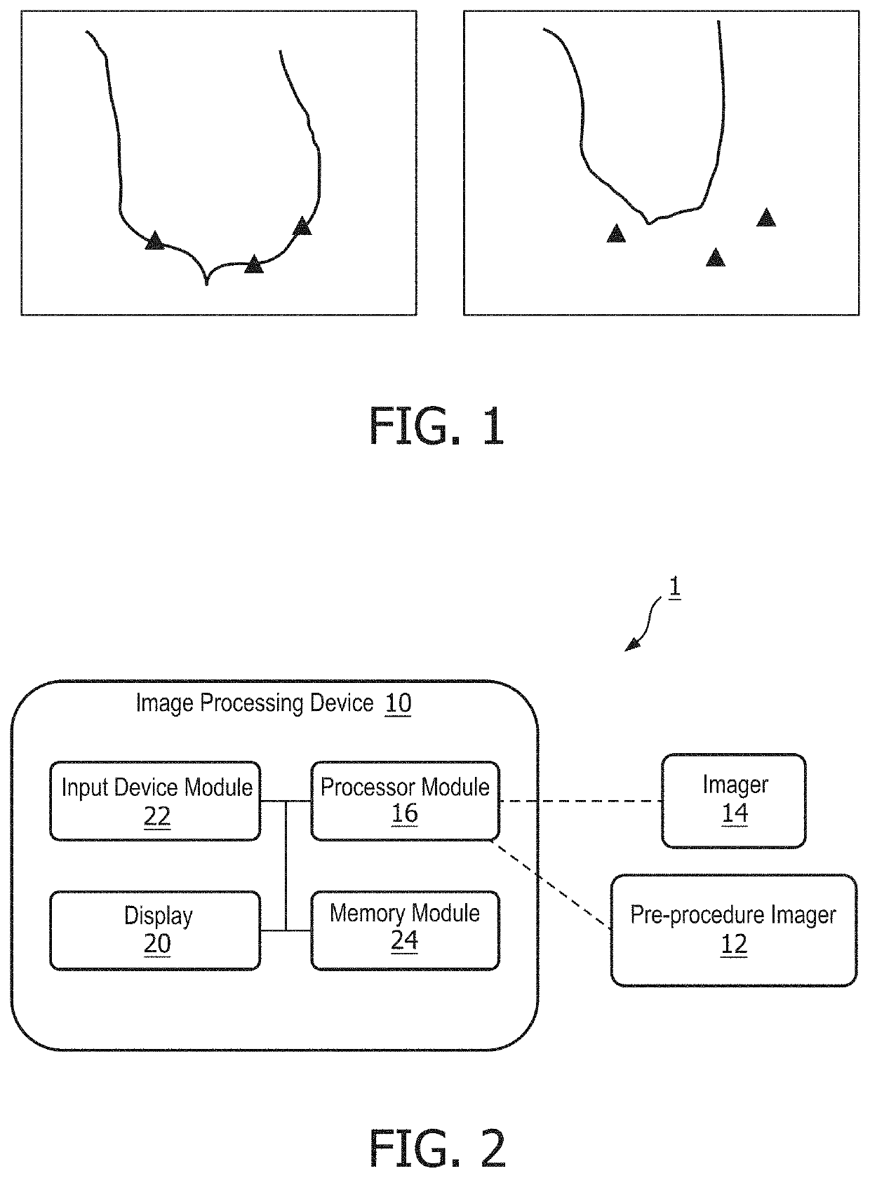 Registration of static pre-procedural planning data to dynamic intra-procedural segmentation data