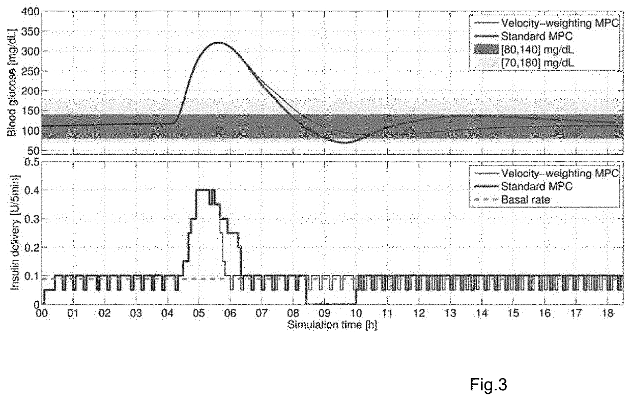 Velocity-weighting model predictive control of an artificial pancreas for type 1 diabetes applications