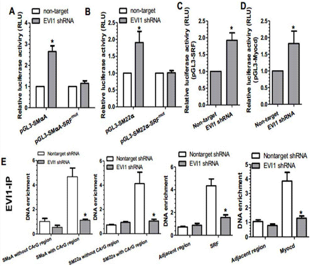 Application of EVI-1 inhibitor for preparing medicines for treating vascular anomaly remodeling diseases