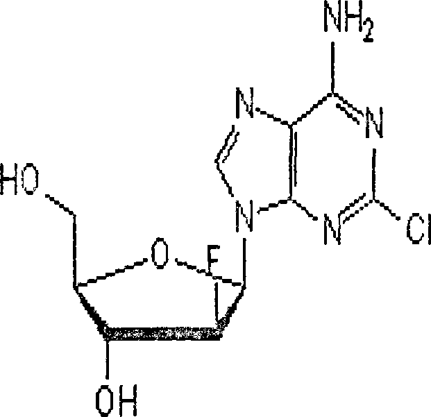 Freezing-dried clofarabine powder injection and its preparation method