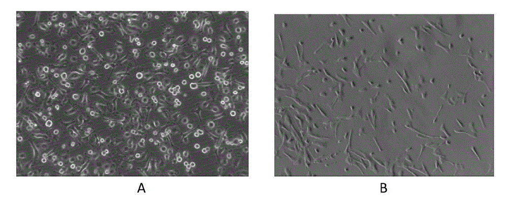 Cell co-culture model for screening antiosteoporosis drugs and application of cell co-culture model