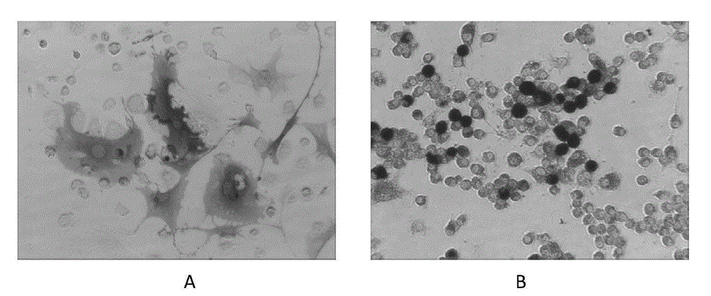 Cell co-culture model for screening antiosteoporosis drugs and application of cell co-culture model