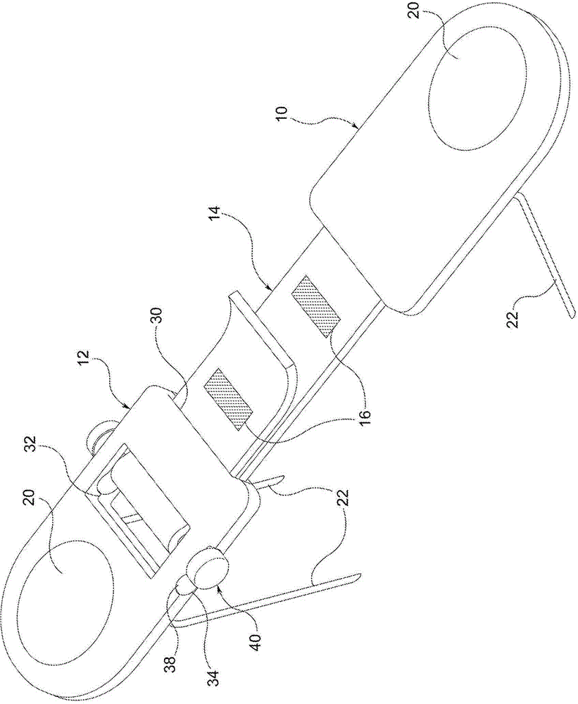 An instrument that stretches/expands skin tissue at the edges of ulcers, wounds